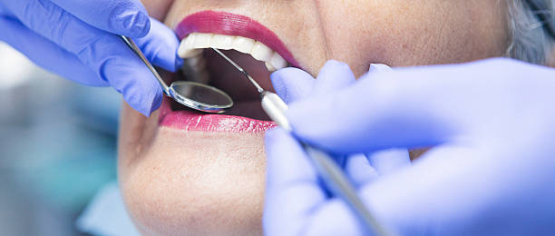 Best Emergency Dentist for Lost Fillings or Crowns in Woodcreek, TX